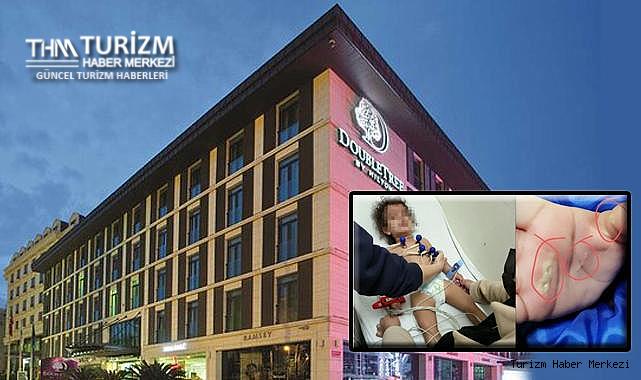 İstanbul'daki 5 yıldızlı otelin müdürüne taksirle yaralama suçundan ceza!