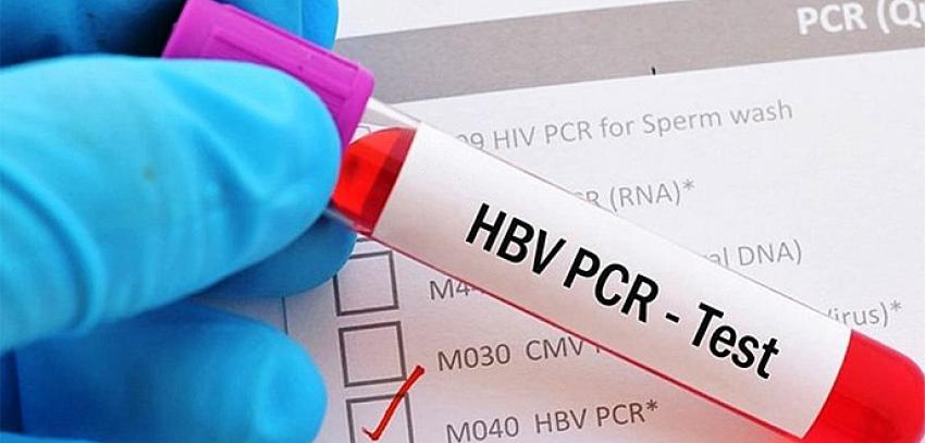 Yurt dışına çıkışlarda istenen PCR test ücreti belli oldu